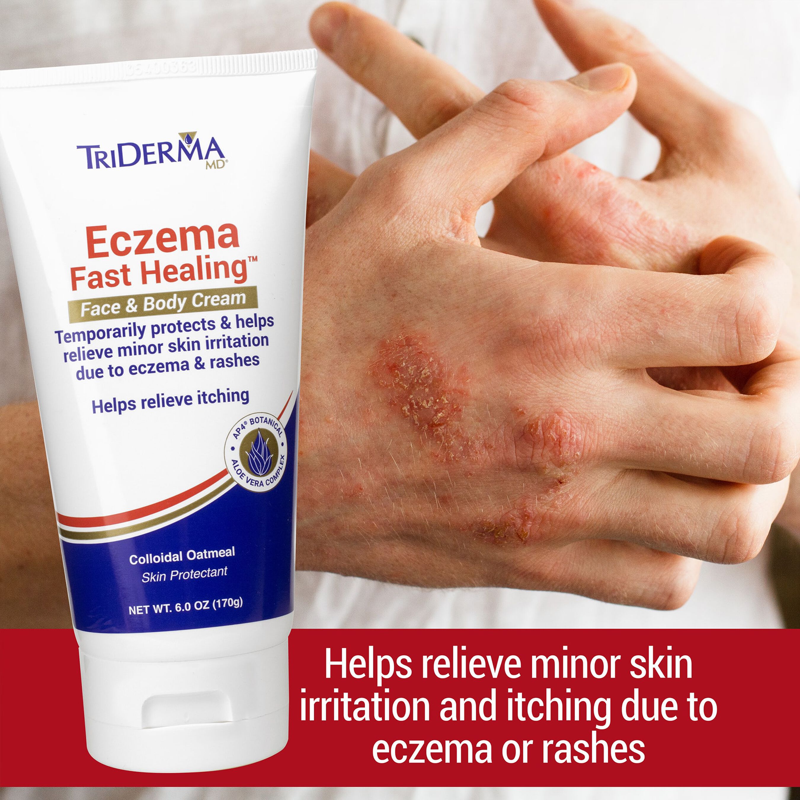 FSA Eligible TriDerma Eczema Fast Healing™ Face & Body Cream, 6 oz